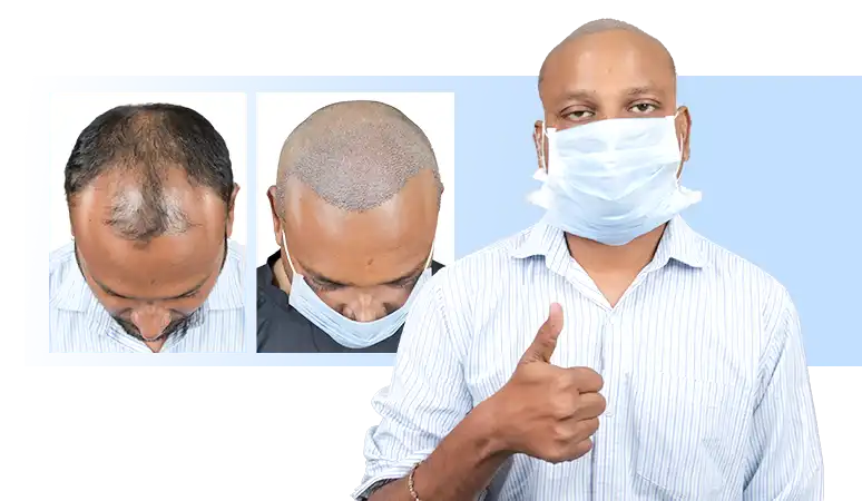 Pratik Virani Hair Transplant